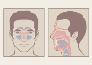 Deviated-Septum-and-Facial-Asymmetry