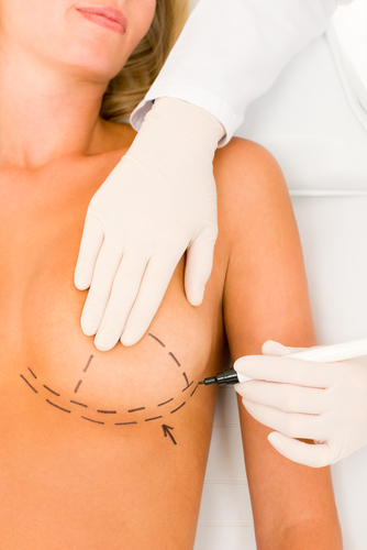 What is Tuberous Breast Deformity?